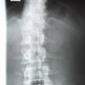 spine and pelvis x-ray